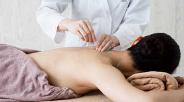 Best Acupuncture in Regina